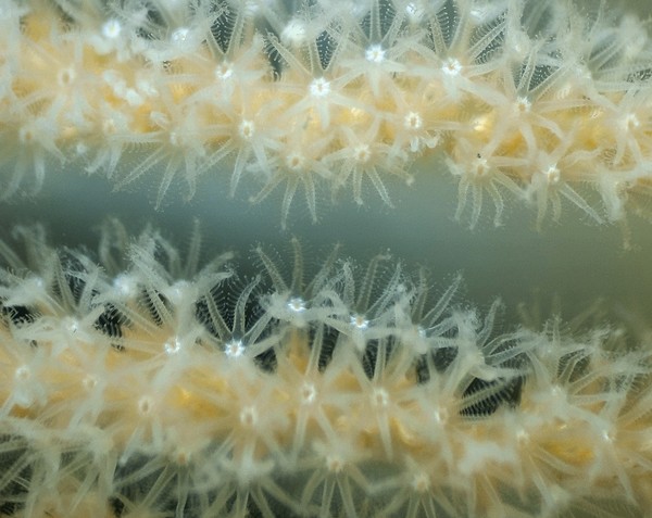 polyps.JPG